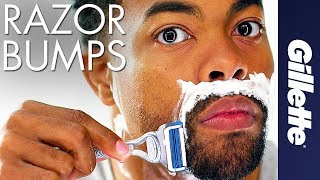 Help Prevent Razor Bumps amp Ingrown Hairs  Gillette SkinGuard [upl. by Rachaba392]