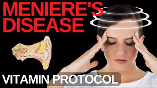 Menieres Disease Reverse Symptoms with These Vitamins [upl. by Papst]