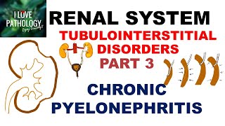 CHRONIC PYELONEPHRITIS  PATHOLOGY [upl. by Assiran]