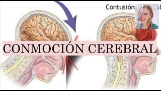 ¿QUÉ ES UNA CONMOCIÓN CEREBRAL FISIOPATOLOGÍA SÍNTOMAS SECUELAS DIAGNÓSTICO TRATAMIENTO [upl. by Crooks]