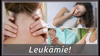 Das sind Symptome von Leukämie [upl. by Daven989]