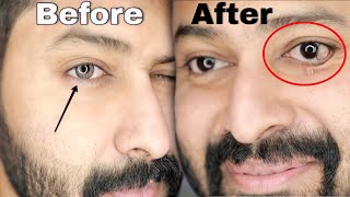 Wearing Color Lens Gone Wrong 😱 First Time Color Lens Must watch before Using  Shadhik Azeez [upl. by Neal]