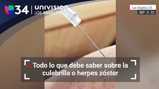 Todo lo que debe saber sobre la culebrilla o herpes zóster [upl. by Yeliab]