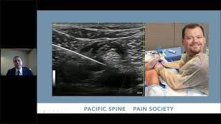 PSPS Training Webinar Series Session 1 Radiofrequency Techniques [upl. by Williamsen]