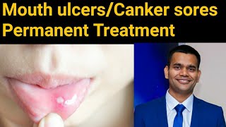 how to get rid of canker sores in minutes [upl. by Koenig]