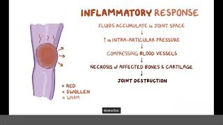 Infectious or Septic Arthritis  Causes Symptoms Diagnosis amp Treatment Pathology [upl. by Beale]