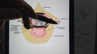 Spinal cord tumors Differences between Intra and Extramedullary lesions [upl. by Atiuqal]