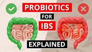 Irritable Bowel Syndrome IBS Do PROBIOTICS For IBS Work [upl. by Aitram6]