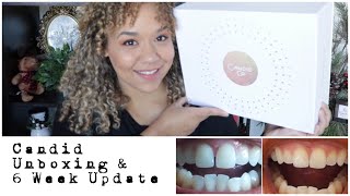 Candid Aligners Unboxing and Teeth Update [upl. by Sillihp923]