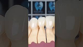 Emaxlayering crowns and veneers [upl. by Rebhun]