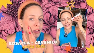 ROSACEA  NJEGA ZRELE KOŽE  nesponzoriran video [upl. by Dey]