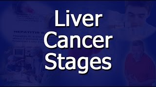 Liver Cancer Stages [upl. by Haggi]