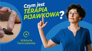 Co To Jest Hirudoterapia Czym Jest Terapia Pijawkowa [upl. by Walther]