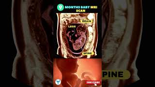 9 month baby ❤️ 9 Month pregnancy scan  Scans in Pregnancy  Fetus on MRI baby shortsvideo scan [upl. by Andris]