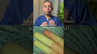 متلازمة رينود Raynaud’s syndrome وسر تغير لون الاصابع مع البرد shorts طب [upl. by Micco]