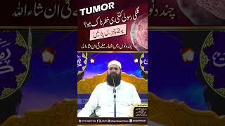 Gilti Rasoli Kitni Hi Khatarnak Ho Yeh 2 Chizain Pilain  tumor treatment  ubqari  urduhindi [upl. by O'Reilly]