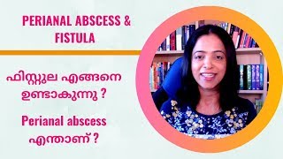 ഫിസ്റ്റുല amp Perianal abscess NO29By Dr Manju Kappen [upl. by Mcleroy109]