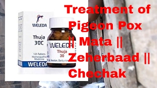 Medicine  Treatment of Pigeon Pox [upl. by Liew]