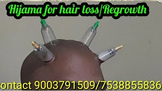 Hijama for hair loss and RegrowthTk health tipsDrTKCupping Therapy for hair [upl. by Nosahc]