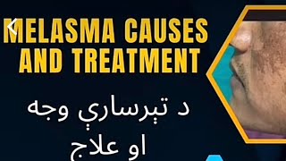 دا ترسیری ملازمہ وجہ آؤ علاج ضرور اوگوریdoctor motivation health healthtips malasma [upl. by Zug]