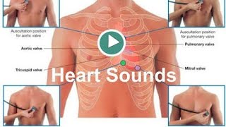 Heart Sounds S1S2S3and others [upl. by Mohsen]