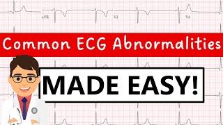 Common ECG abnormalities  MADE EASY [upl. by Rozanne]