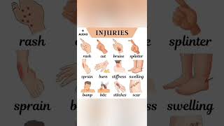 Types of Injuries  Injury Names [upl. by Saixela]