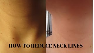 Benefits of Petroleum Jelly for Neck wrinklesBeautywdbrain [upl. by Ayot]