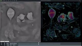 mESC cell mitosis [upl. by Sonstrom]