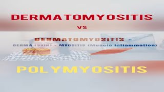 Dermatomyositis vs Polymyositis  What is the difference dermatomyositis polymyositis [upl. by Rhona209]