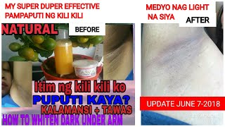 Paano magpaputi ng Kili KiliTanggal Putok foreverKili kili GoalsSolusyon sa mabahong kili kili [upl. by Neehsuan36]