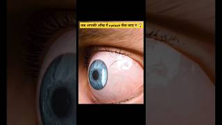 जब आपकी आँख में eyelash फँस जाए👁️😱When An Eyelash Gets Stuck In Your Eyefacts shorts ytshorts [upl. by Eradis]