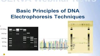 SERVA Webinar DNA Elektrophorese  Die Grundlagen Deutsch [upl. by Ewan]