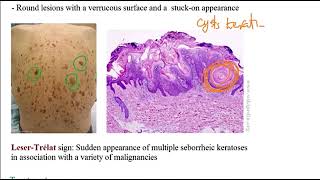 USMLE ACE Video 192 Skin Disorders Overview [upl. by Seugirdor]