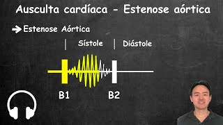 Ausculta cardiaca estenose aortica e insuficiencia aortica [upl. by Sinai]