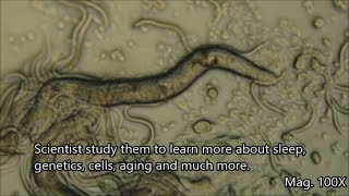 C elegans under the Microscope [upl. by Retsevel799]