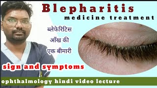 blepharitis treatment  blepharitis  treatment of blepharitis  blepharitis  hindiophthalmology [upl. by Mathe]