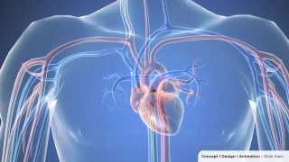 Cardiac catheterization  3D Animation 1080p [upl. by Inhsor]