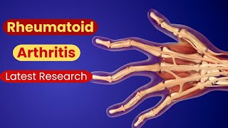 Rheumatoid Arthritis Explained Symptoms Diagnosis and Latest Research [upl. by Etterual]