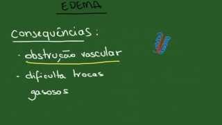 Hiperemia Congestão e Hemorragia  Resumo  Patologia Geral [upl. by Aissyla]