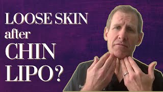 Can I Get Rid of Loose Skin After Chin Lipo [upl. by Fugere]