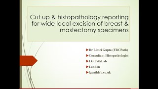 LG PathLab webinars Breast cut up and microscopic reporting  Dr Limci Gupta [upl. by Scotney170]