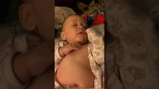 Example of Retractions Belly Breathing and Tachypnea in Infant [upl. by Ivens]