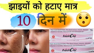 kojicid gel  kojicid gel uses in hindi  kojic acid cream  चेहरे से झाइयों को हटाए [upl. by Kobe949]