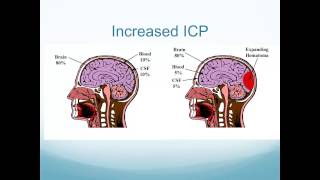 Altered Neurologic Function [upl. by Keller]