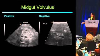 Ultrasound First and the Pediatric Abdomen  Lynn Fordham MD [upl. by Ahsiliw]