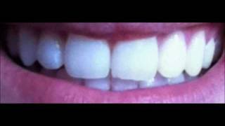 Blend a med Whitestrips [upl. by Eirrek]