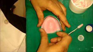 denture base preparation [upl. by Xed]