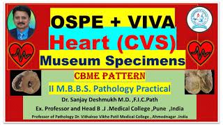 Pathology practical Heart Specimens Dr Sanjay Deshmukh MD Best video Rapid Revision Pathology [upl. by Nirihs]