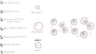 7 Types of Anaemia [upl. by Glenda]